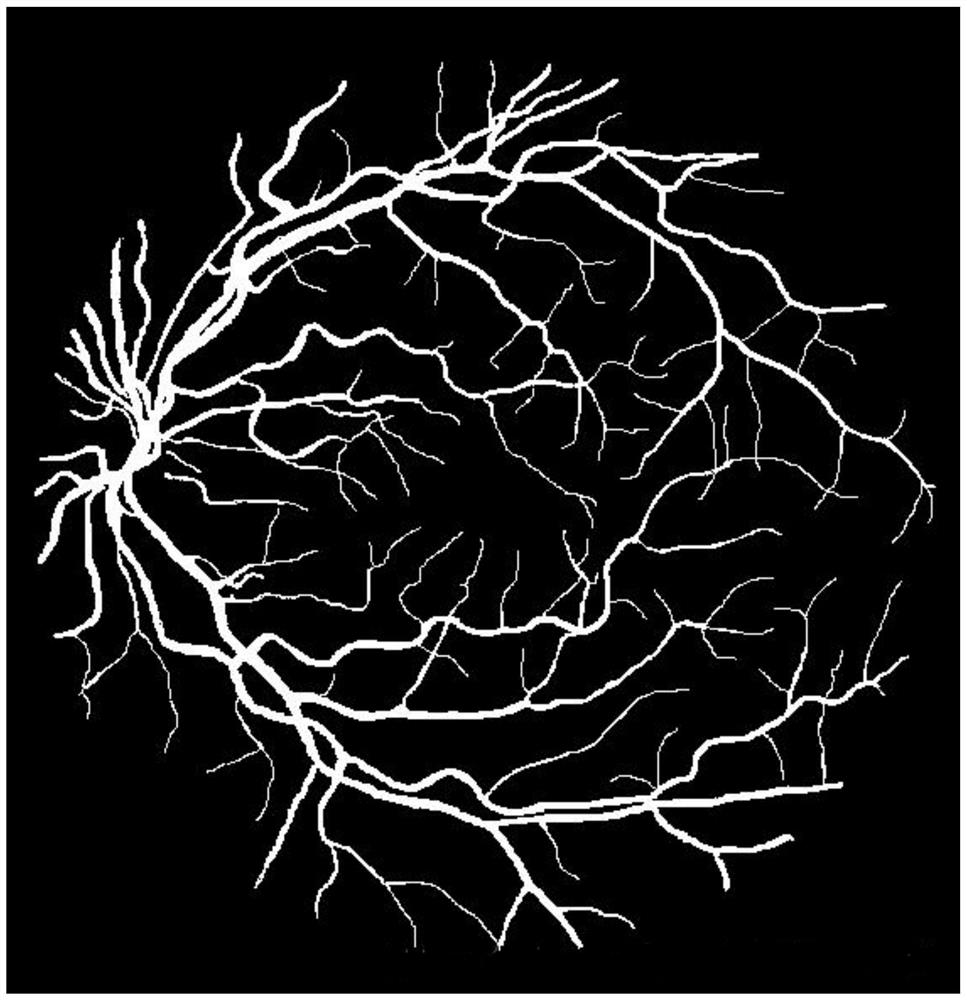 A fundus image stitching method based on deep neural network