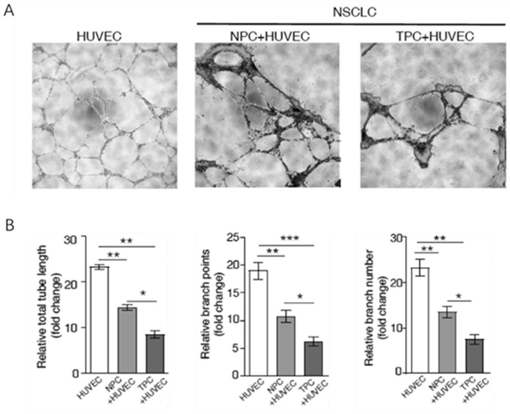 Construction method of endothelial cell and pericyte co-culture model for researching tubulation