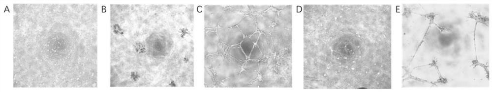 Construction method of endothelial cell and pericyte co-culture model for researching tubulation