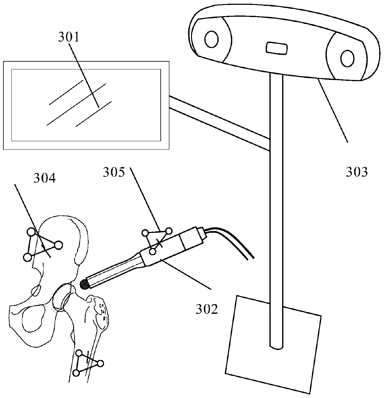 Auxiliary positioning method, positioning device and system for joint replacement