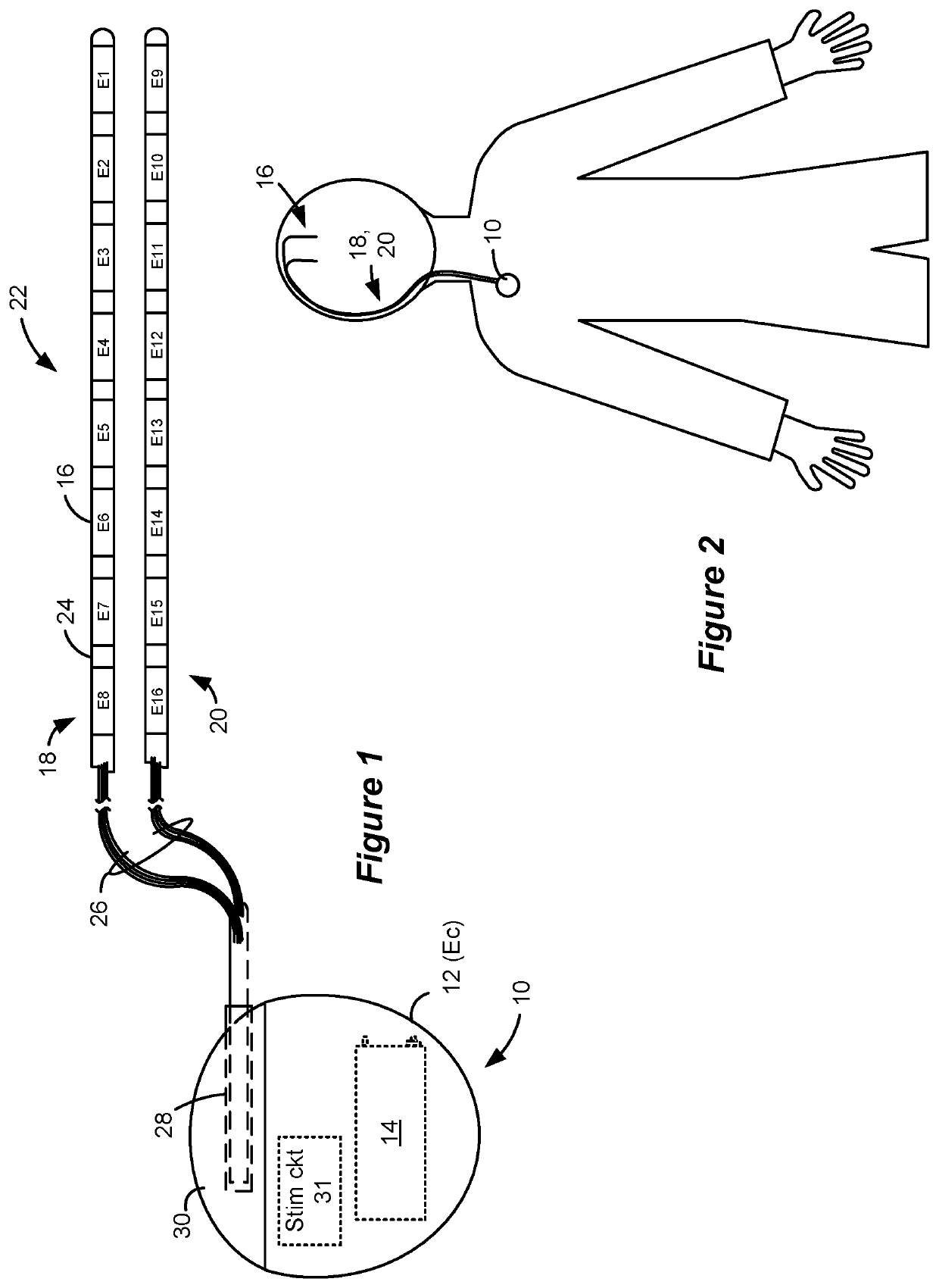 Selective electrical modulation of neural populations