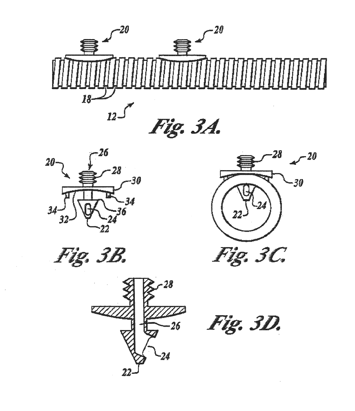 System and method for removing moisture from water laden structures