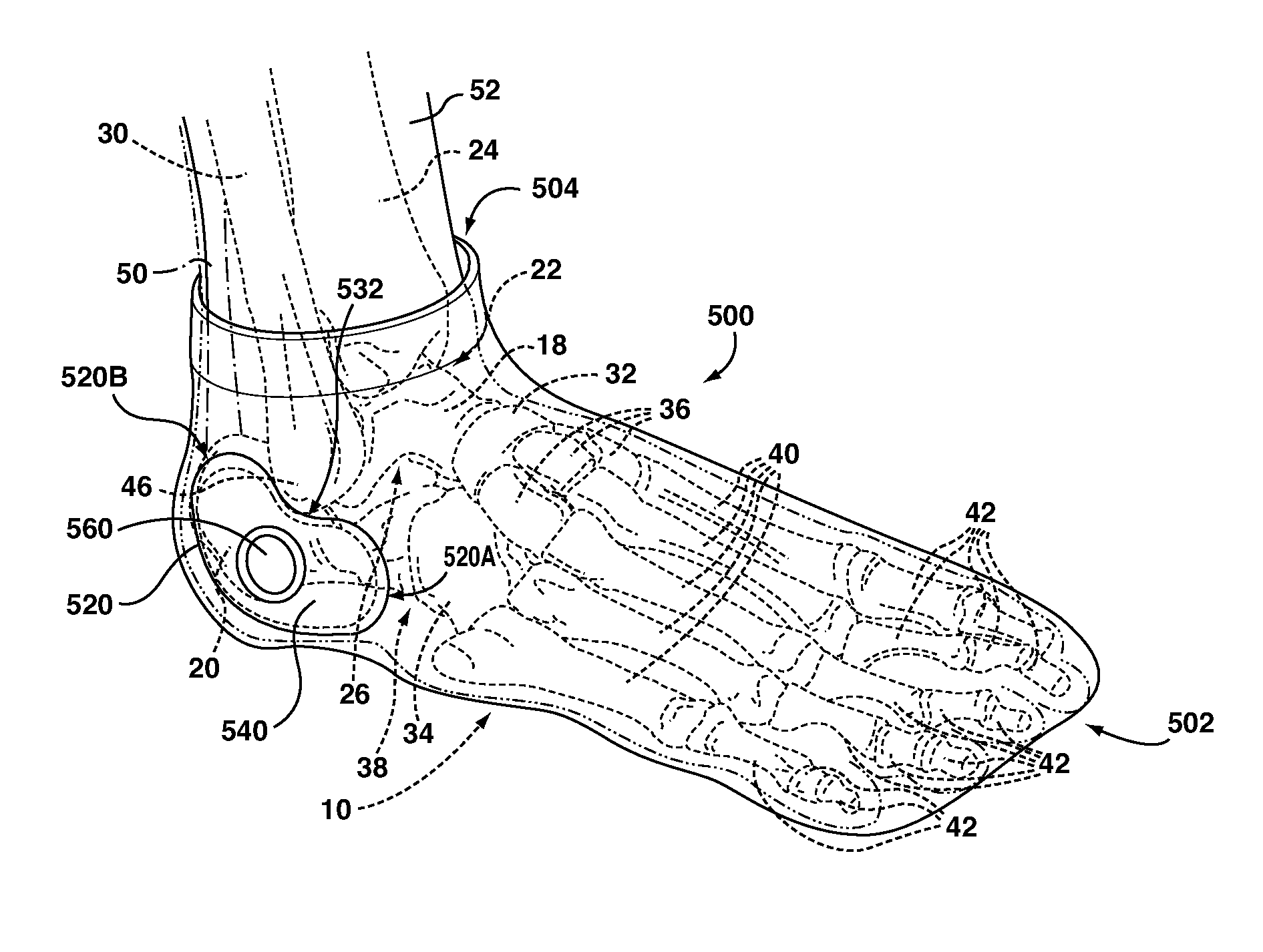 Foot stabilizer socks and stabilizer pads therefor