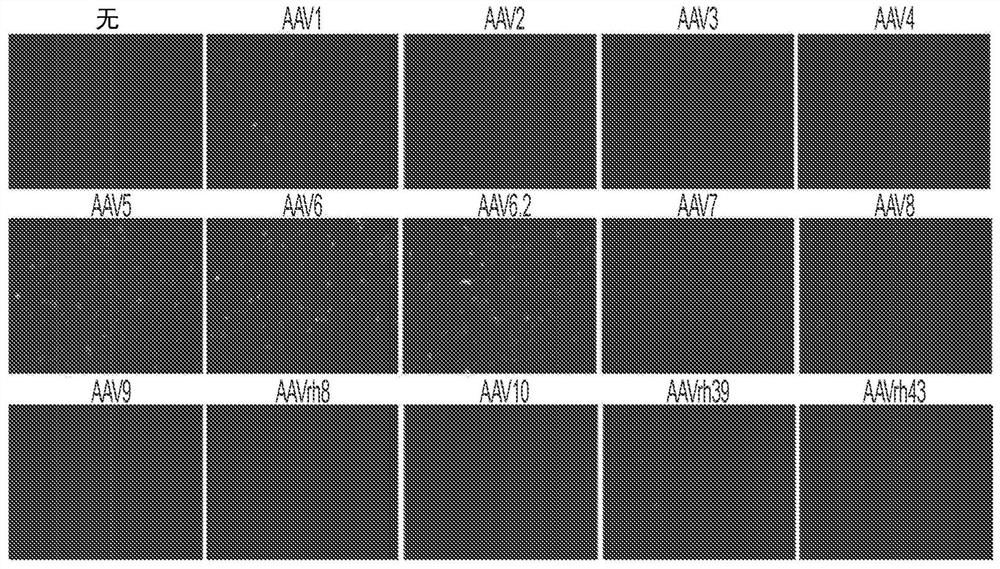 Gene therapeutics for treating bone disorders