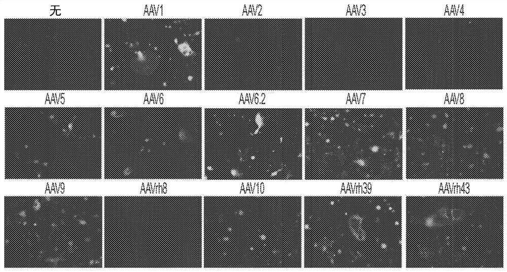 Gene therapeutics for treating bone disorders