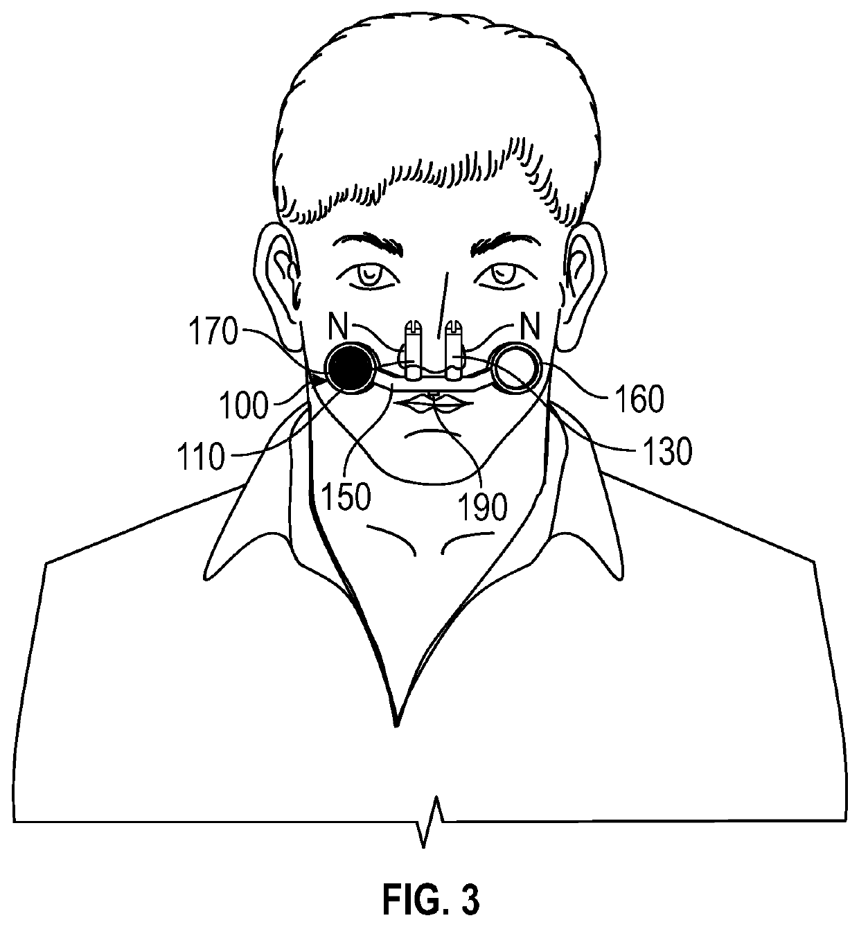 Nasal air filtration device