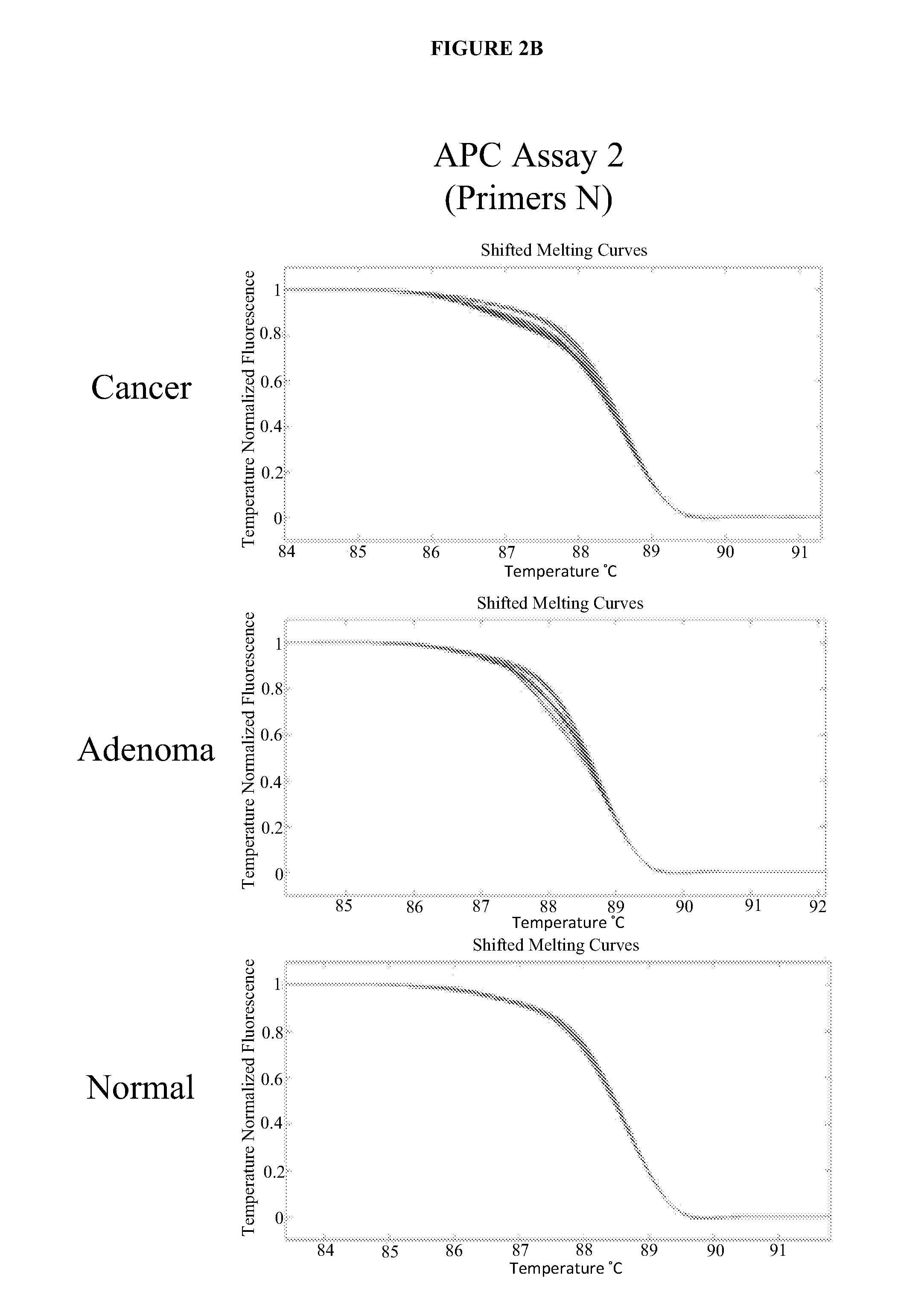 Methods and materials for detecting colorectal cancer and adenoma