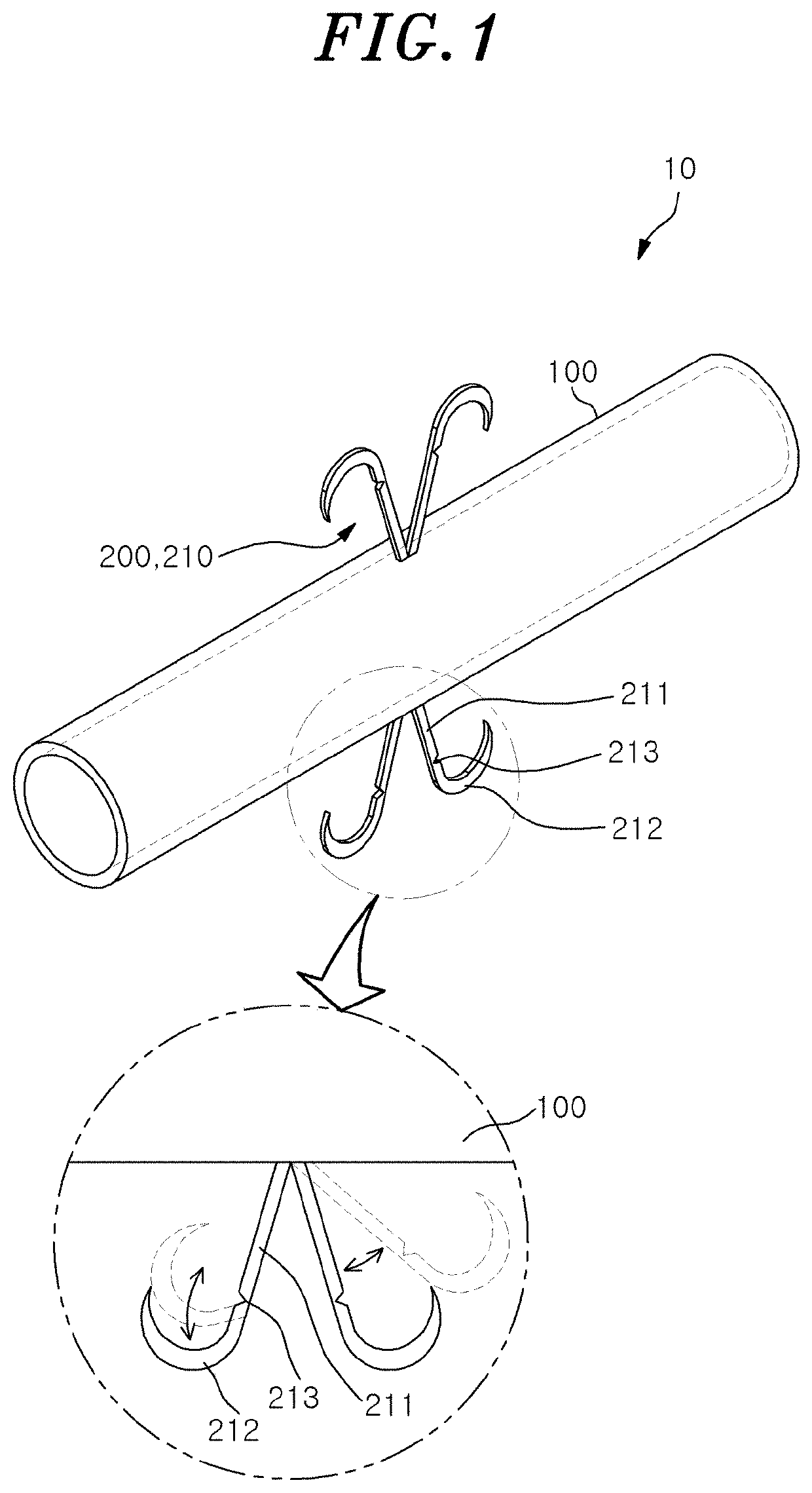 Stent for anastomosis of different kinds of organs