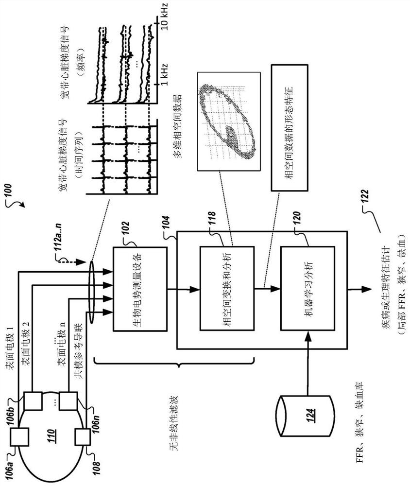 Non-invasive method and system for measuring myocardial ischemia, stenosis identification, localization and fractional flow reserve estimation