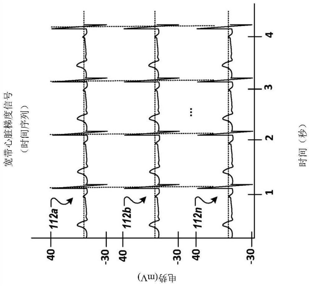 Non-invasive method and system for measuring myocardial ischemia, stenosis identification, localization and fractional flow reserve estimation