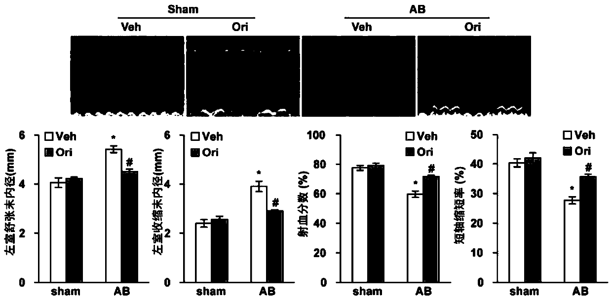 Use of oridonin in the preparation of anti-myocardial remodeling drugs