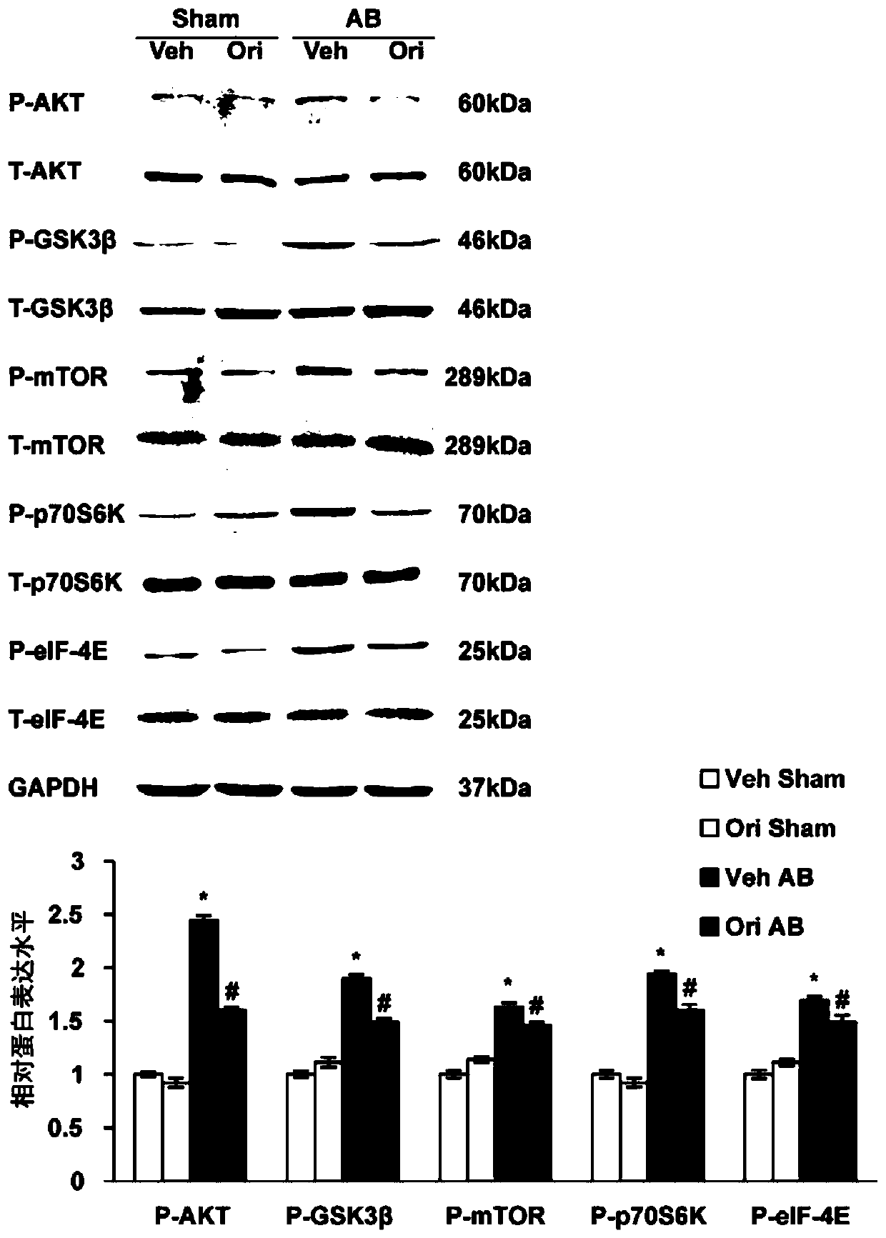 Use of oridonin in the preparation of anti-myocardial remodeling drugs