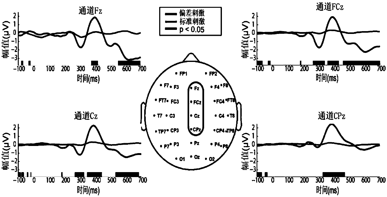 Assessment method of auxiliary CRS-R scale auditory shock based on brain-computer interface