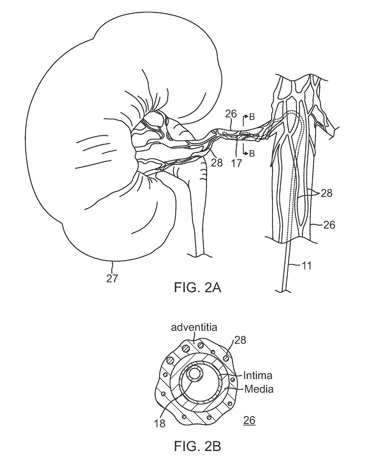 Renal ablation and visualization system and method with composite anatomical display image