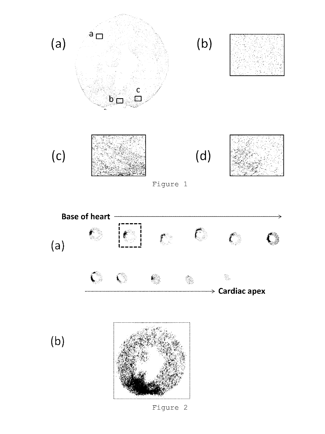 Non-invasive diagnostic imaging agent for heart disease