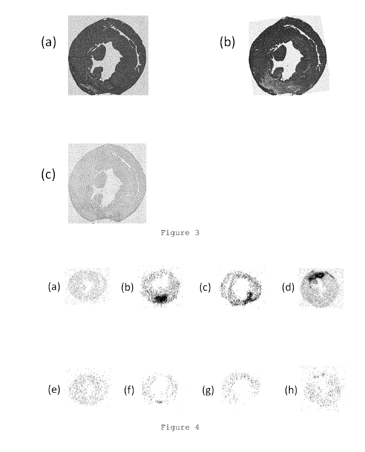 Non-invasive diagnostic imaging agent for heart disease