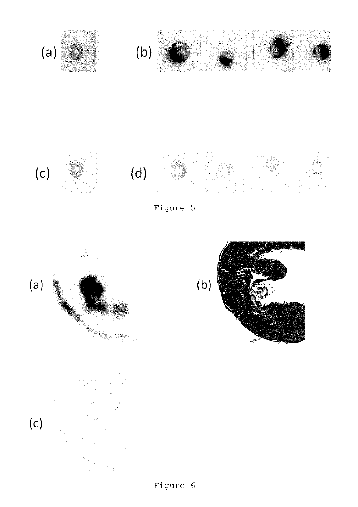 Non-invasive diagnostic imaging agent for heart disease