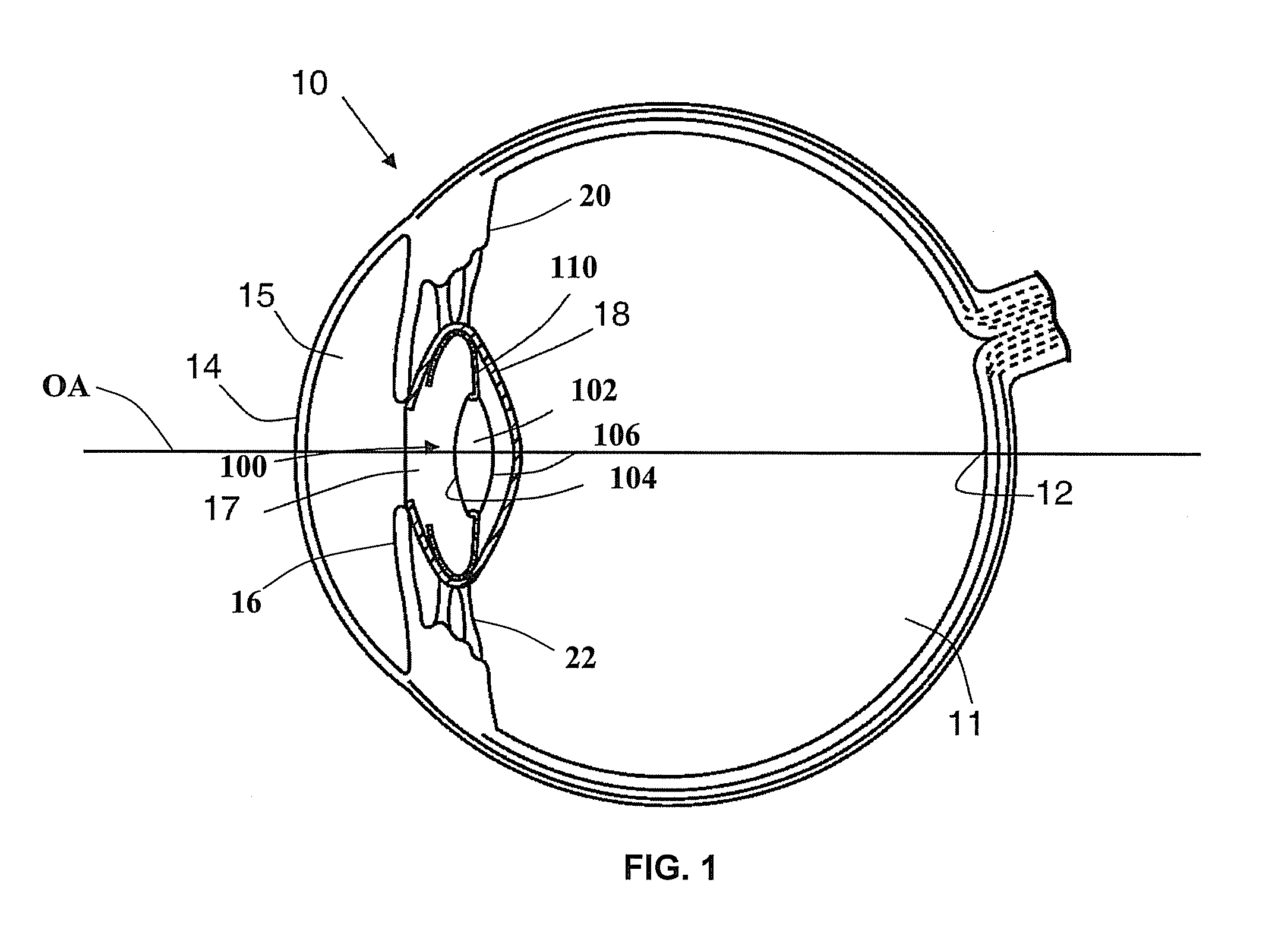 Intraocular lens having extended depth of focus