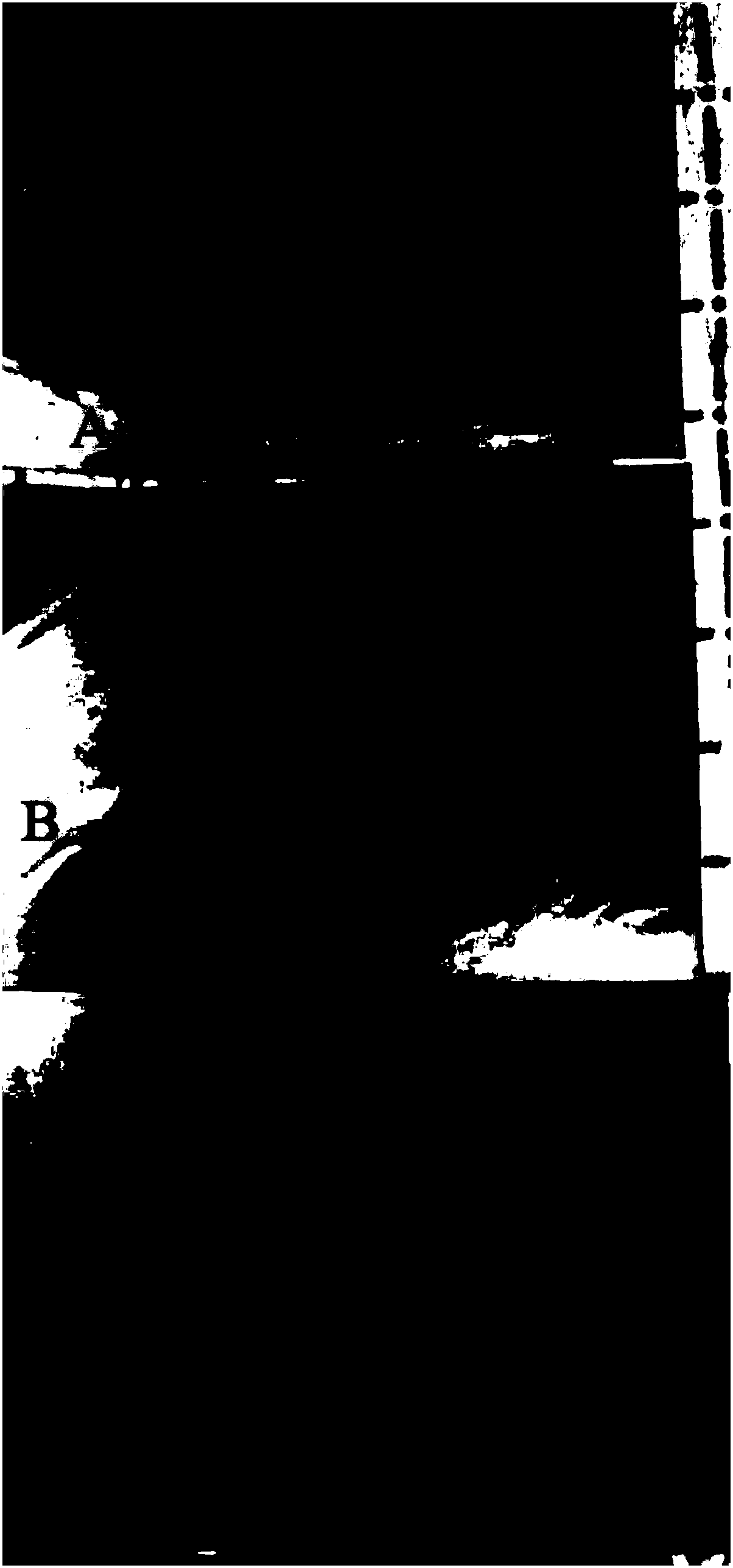 Drug for treating burn, scald and ulcer and preparation method thereof