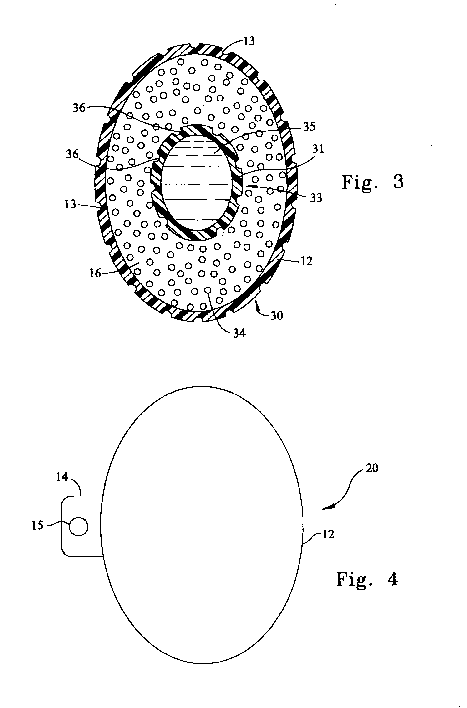 Prosthetic testicle