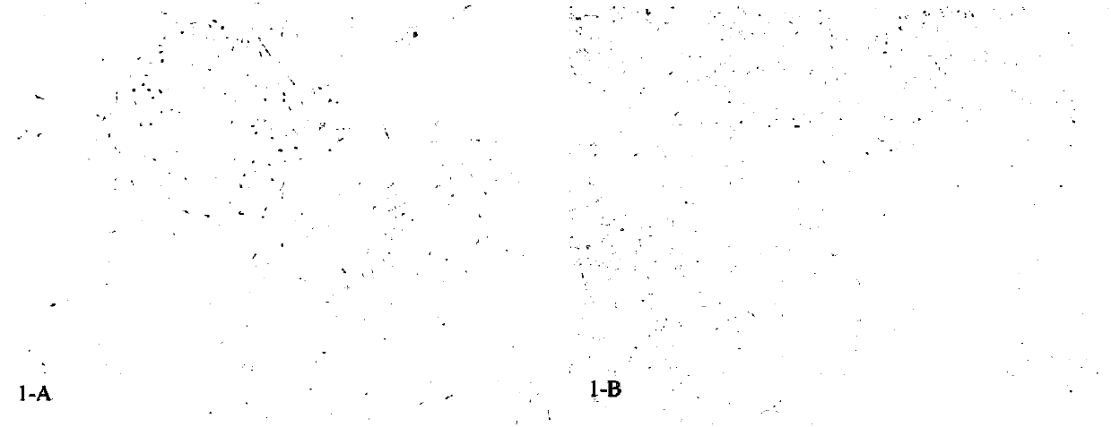 Cryopreservation method for adherent culture of cells