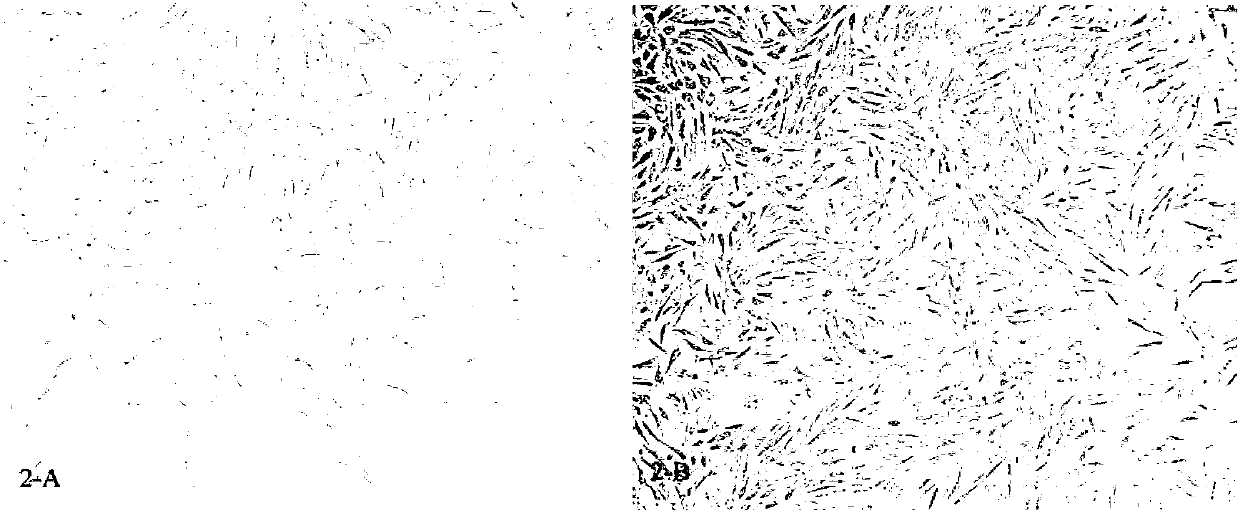 Cryopreservation method for adherent culture of cells