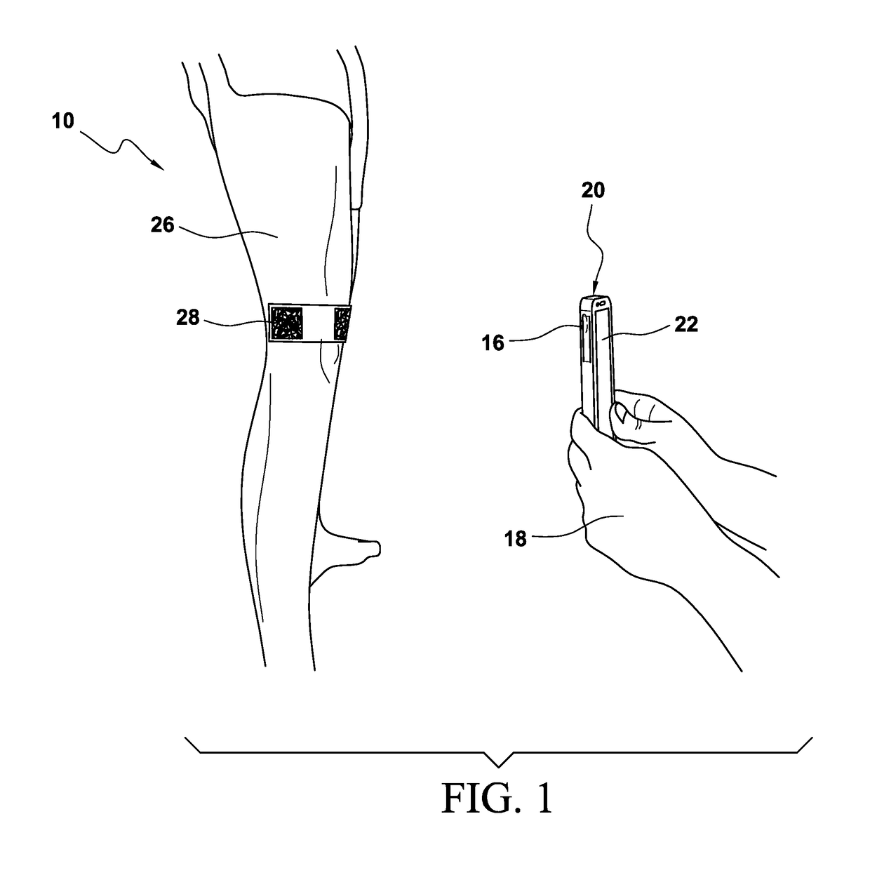 Measurement and ordering system for orthotic devices