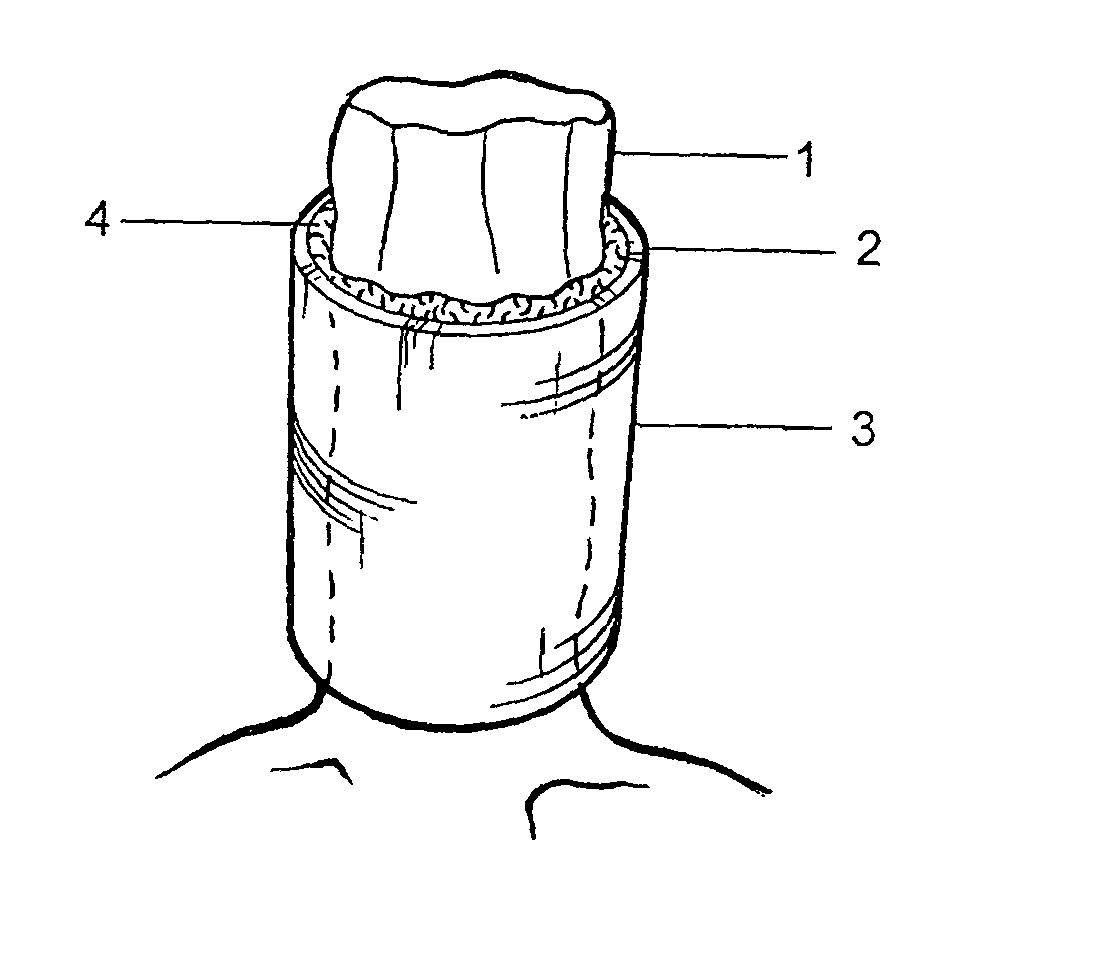 System for protecting trees and structures against infestation