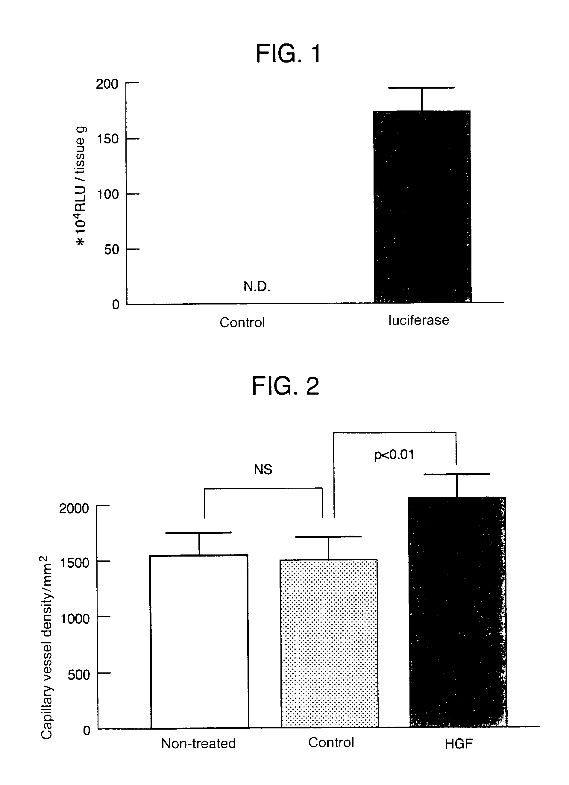 Gene therapy for cardiomyopathy