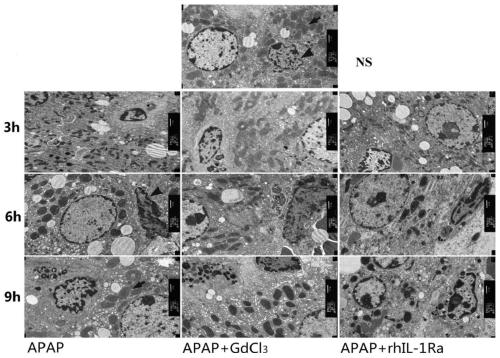 Kupffer cell activity inhibitor and application of inhibitor in preparation of drug for treating acute liver failure