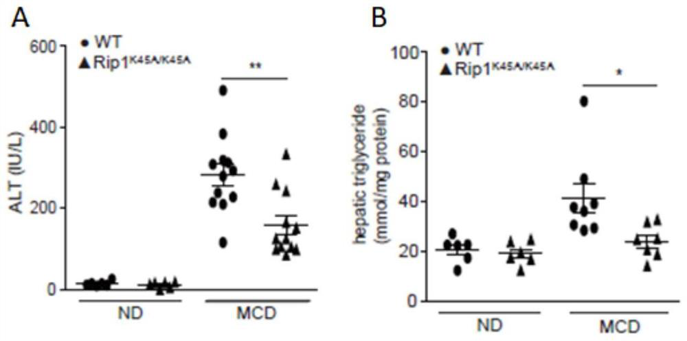 Application of macrophage-targeting RIPK1 and RIPK1 inhibitor in screening and preparing liver injury diagnosis and treatment medicine