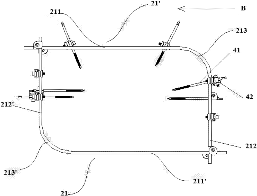 External fixing device for pelvis