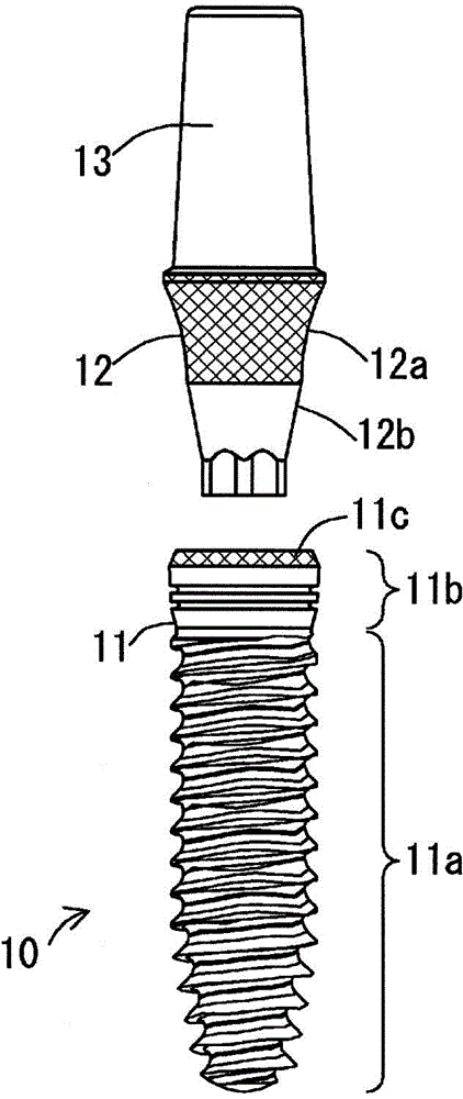 Dental implant