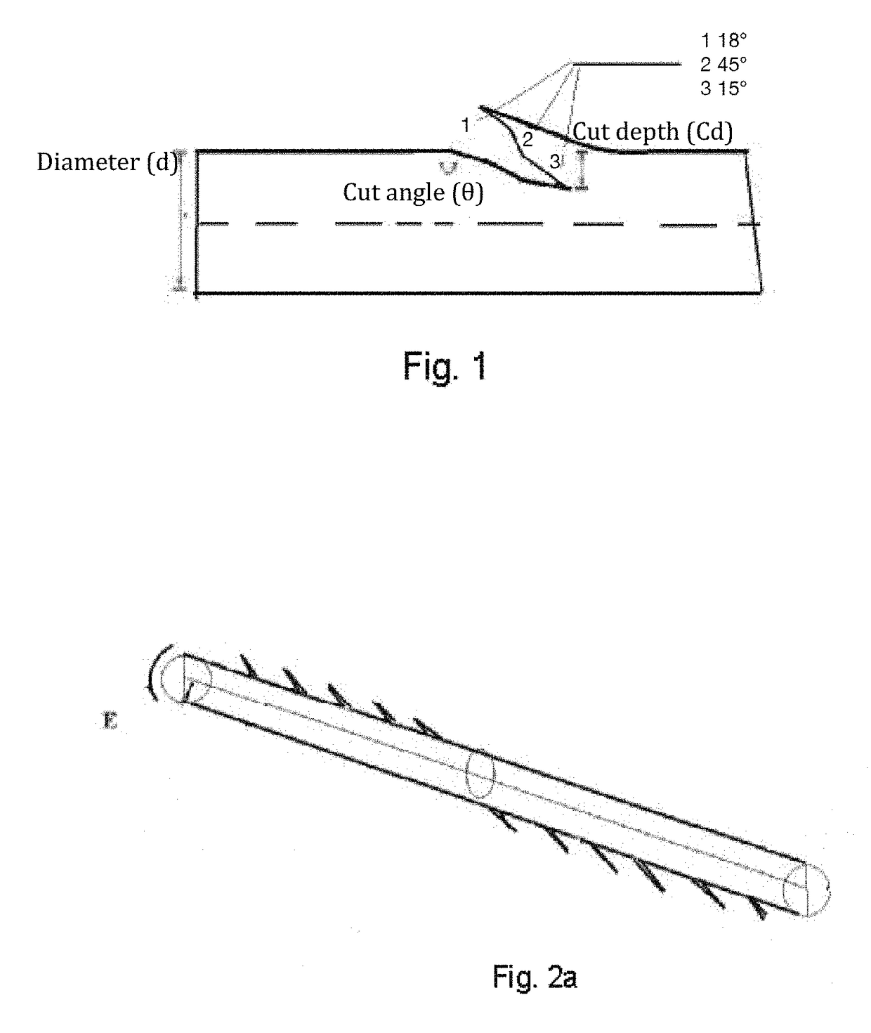 Minimally invasive surgical technique to perform vaginal ostioplastic and anus tightening