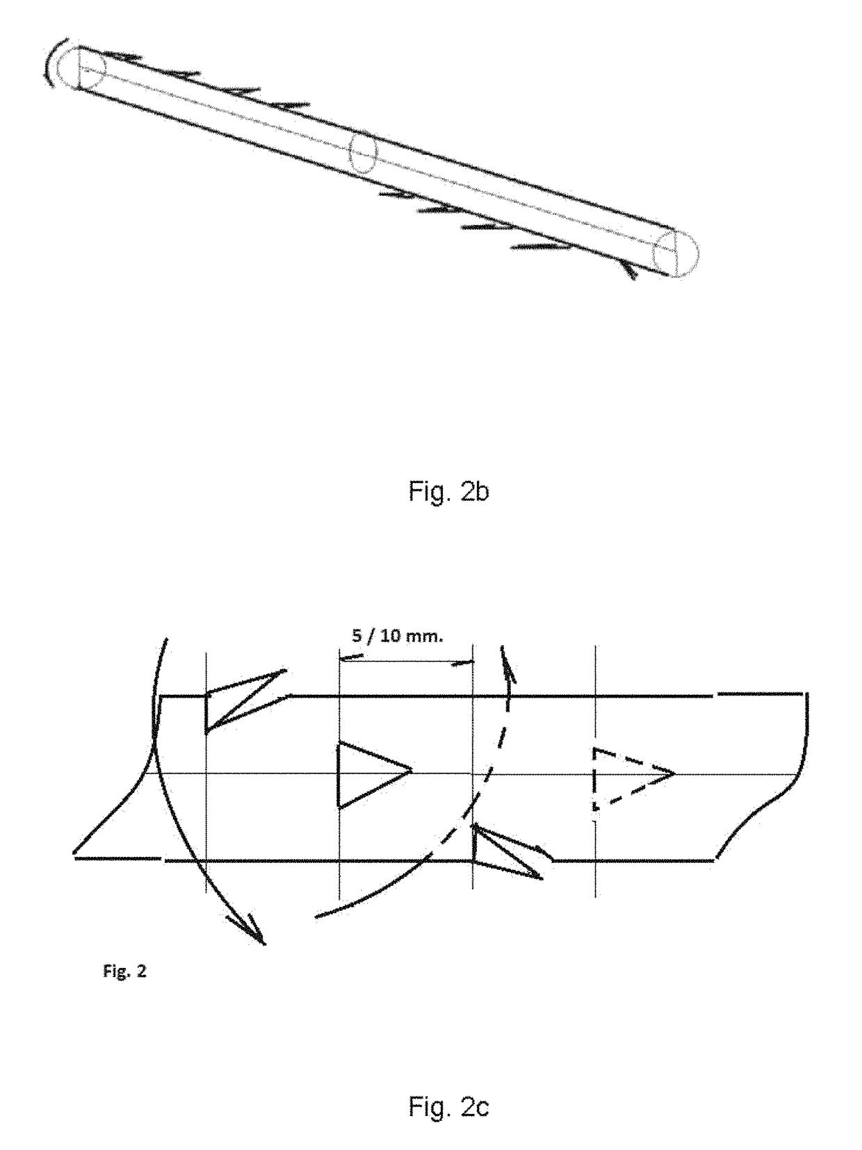 Minimally invasive surgical technique to perform vaginal ostioplastic and anus tightening