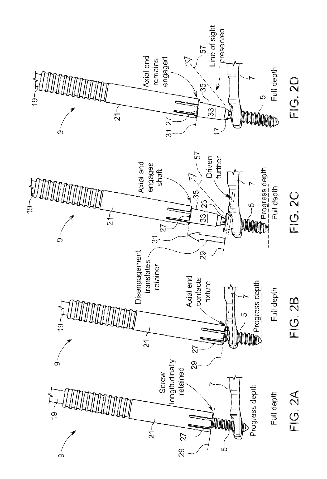 Screw retention sleeve