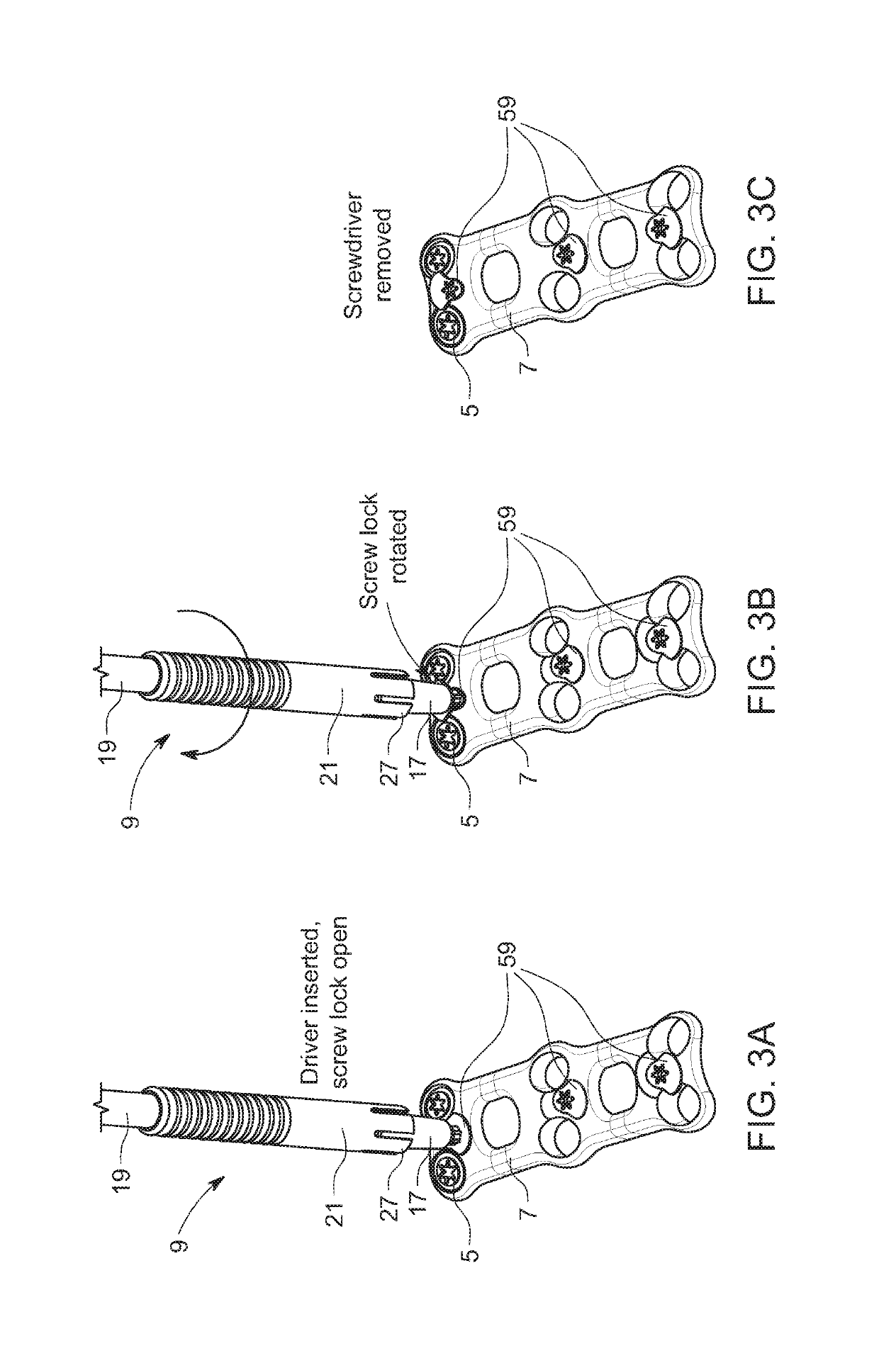 Screw retention sleeve