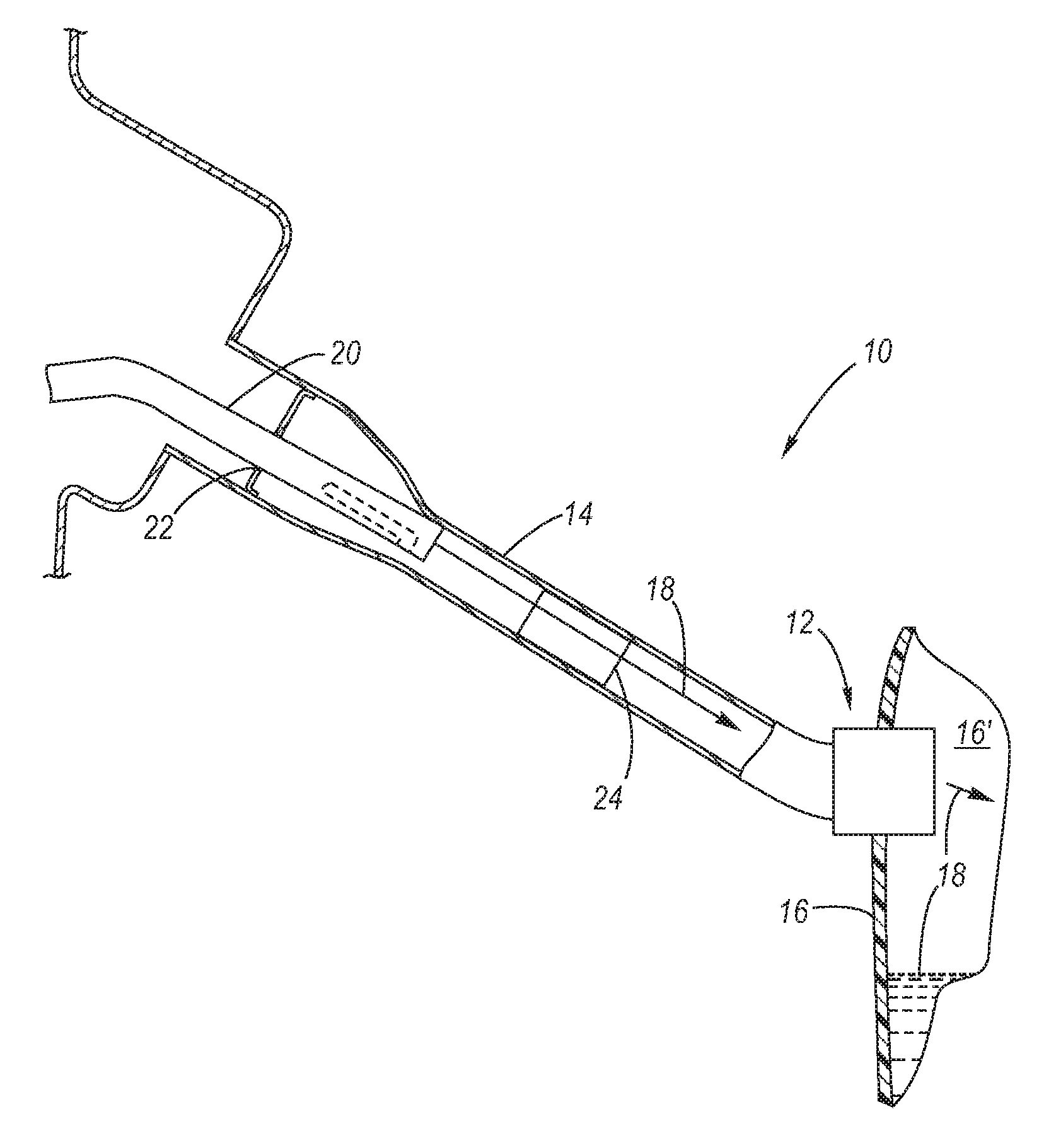 Fuel System Inlet Check Valve with Flame Arresting feature