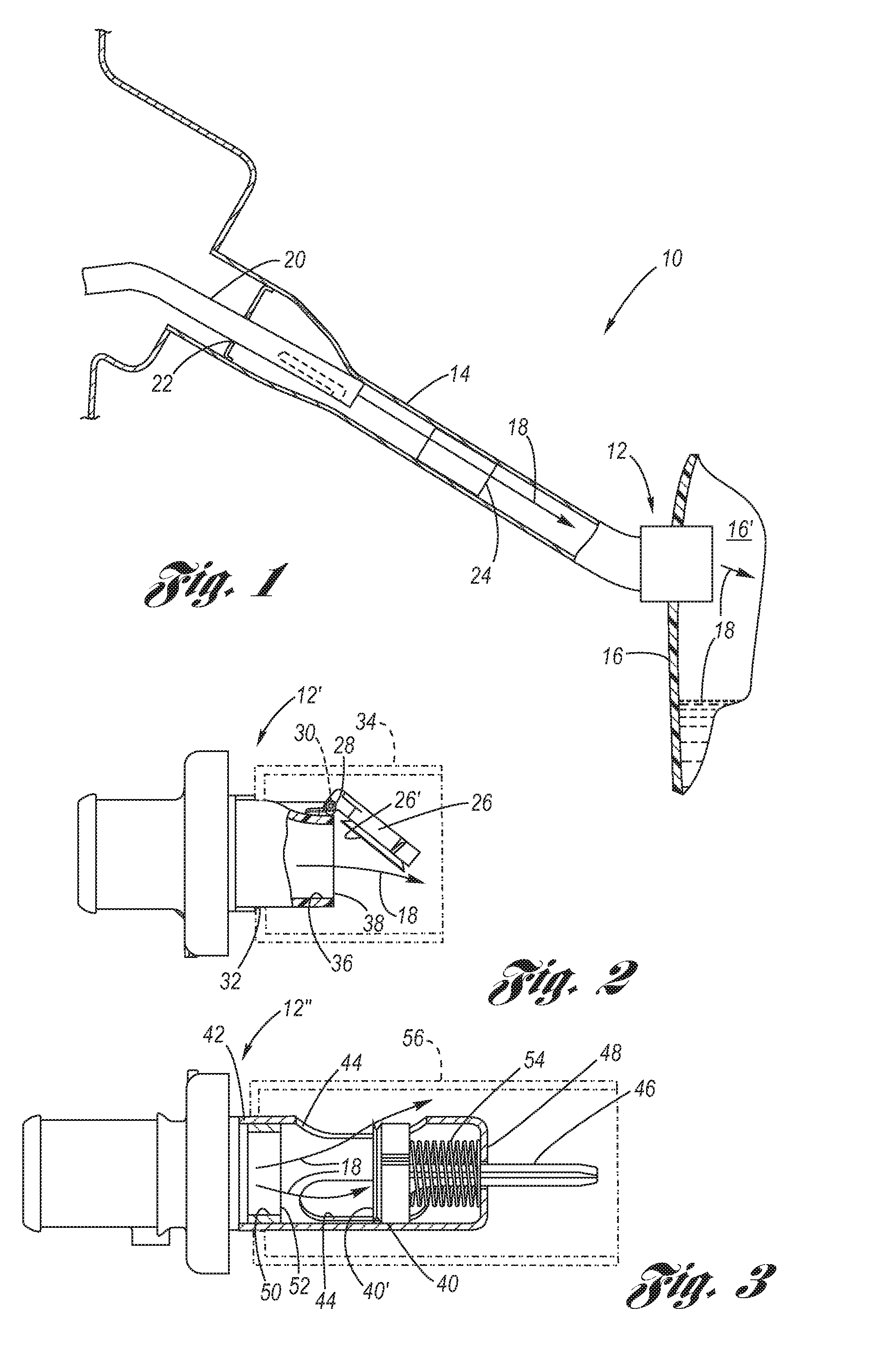 Fuel System Inlet Check Valve with Flame Arresting feature