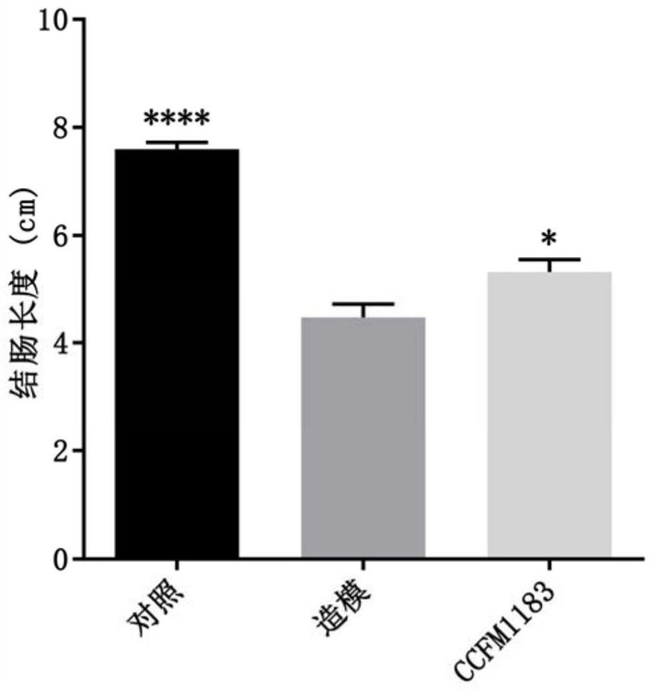 Strain Phocaeicola sp. capable of relieving ulcerative colitis and application of strain Phocaeicola sp.