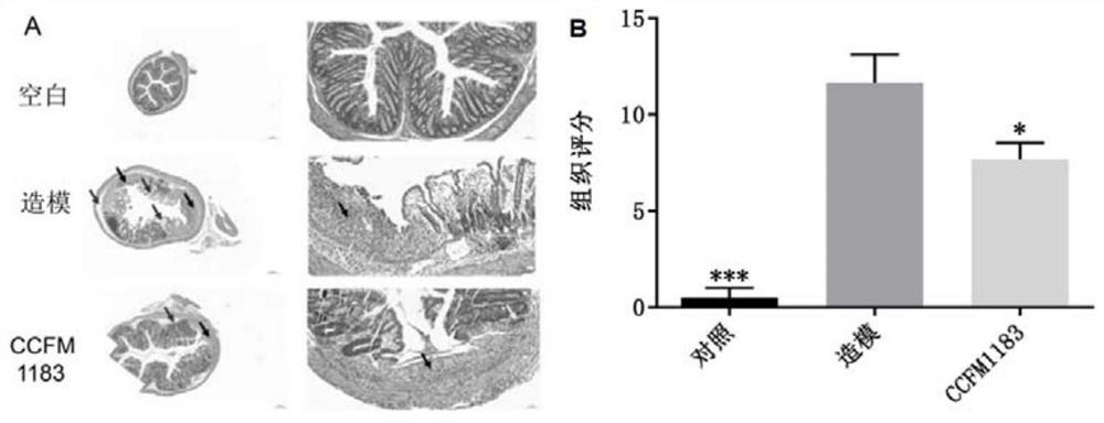 Strain Phocaeicola sp. capable of relieving ulcerative colitis and application of strain Phocaeicola sp.