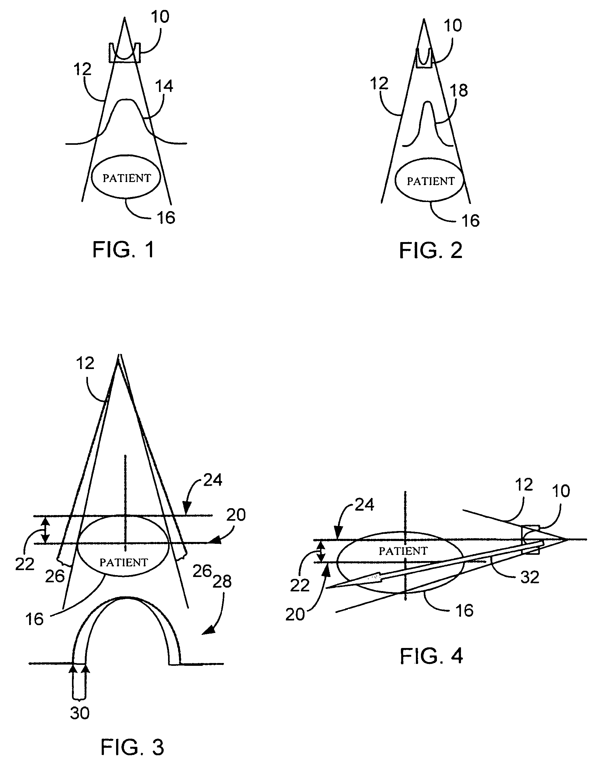 System and method of determining a user-defined region-of-interest of an imaging subject for x-ray flux management control