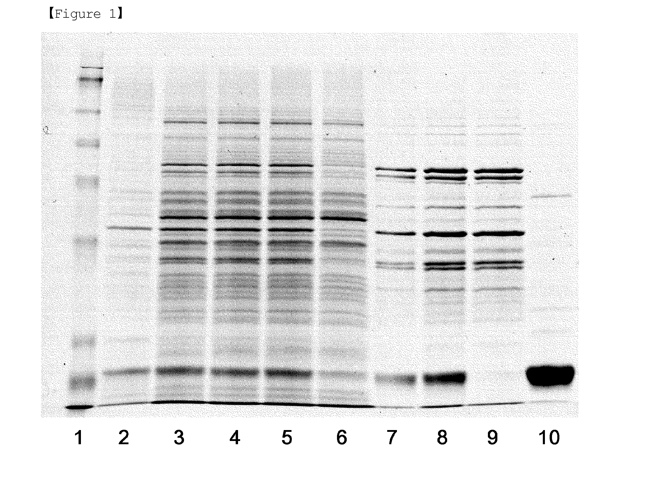 Method for purifying human granulocyte-colony stimulating factor from recombinant e. coli