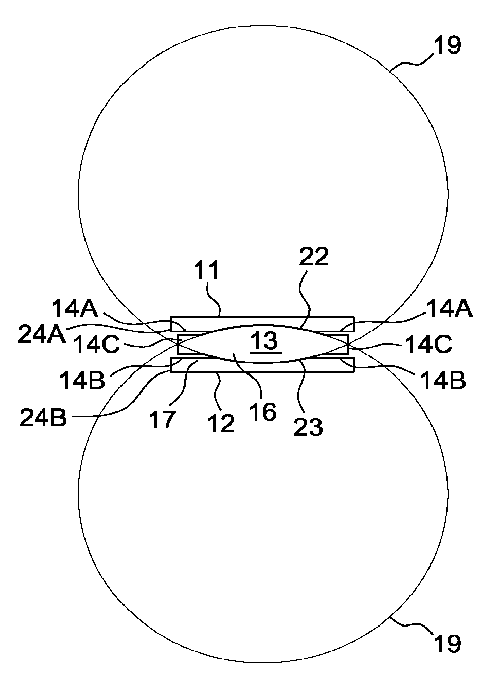 Physologically Movable Intervertebral Disc Prosthesis for the Lumbar and Cervical Spine