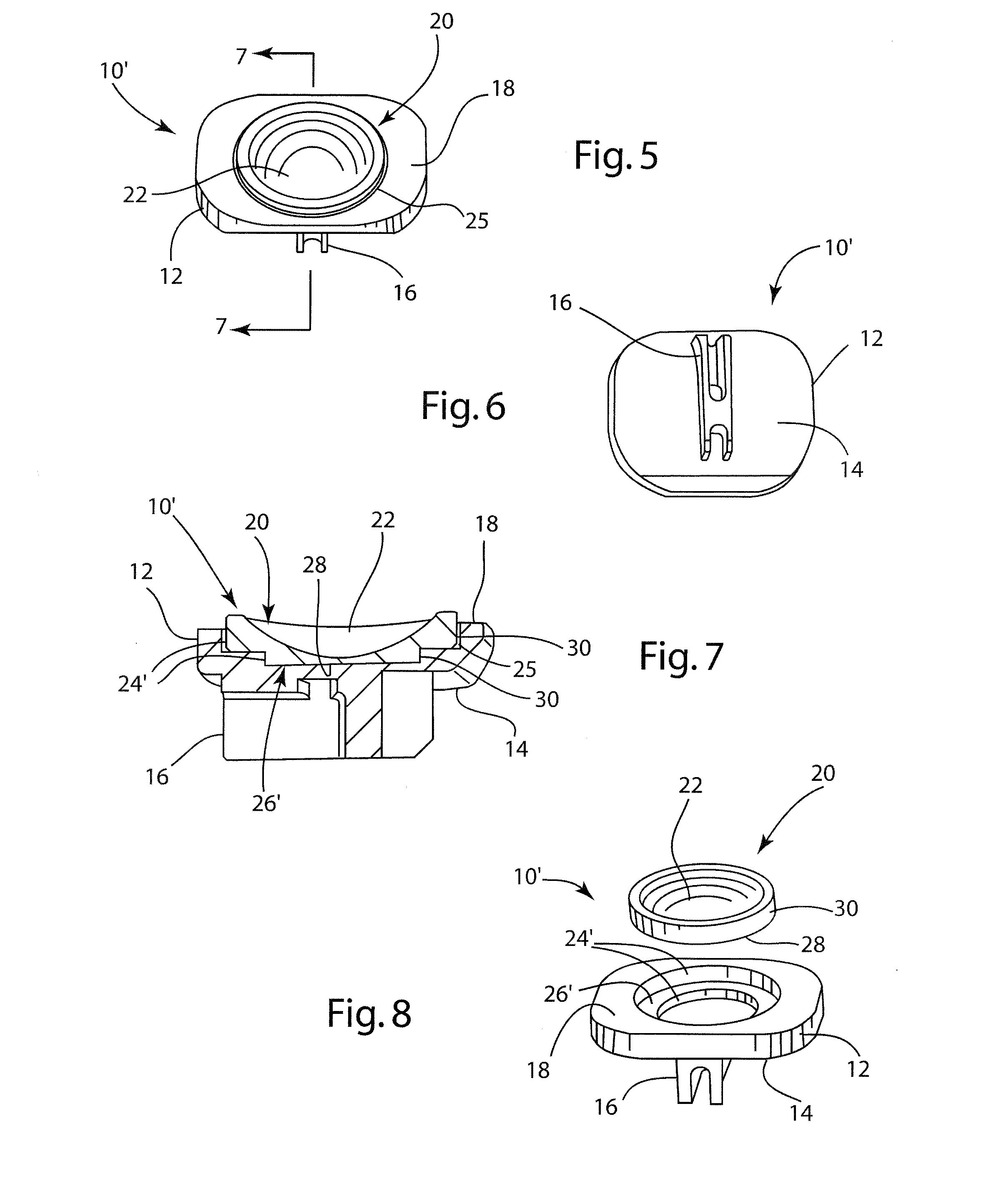 Intervertebral implant with keel