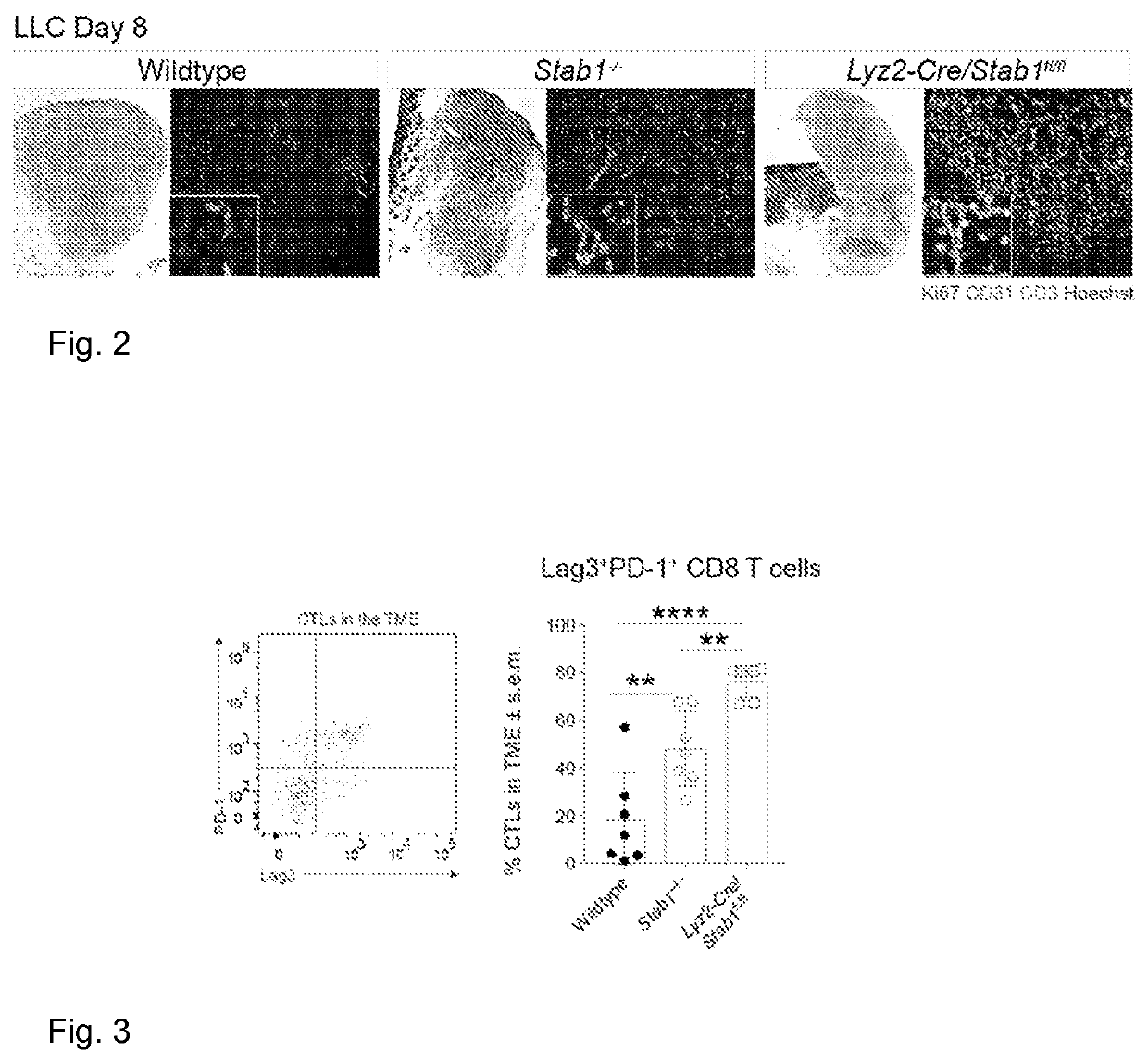 Treatment of cancer with clever-1 inhibition in combination with pd-1/pd-l1 inhibitor