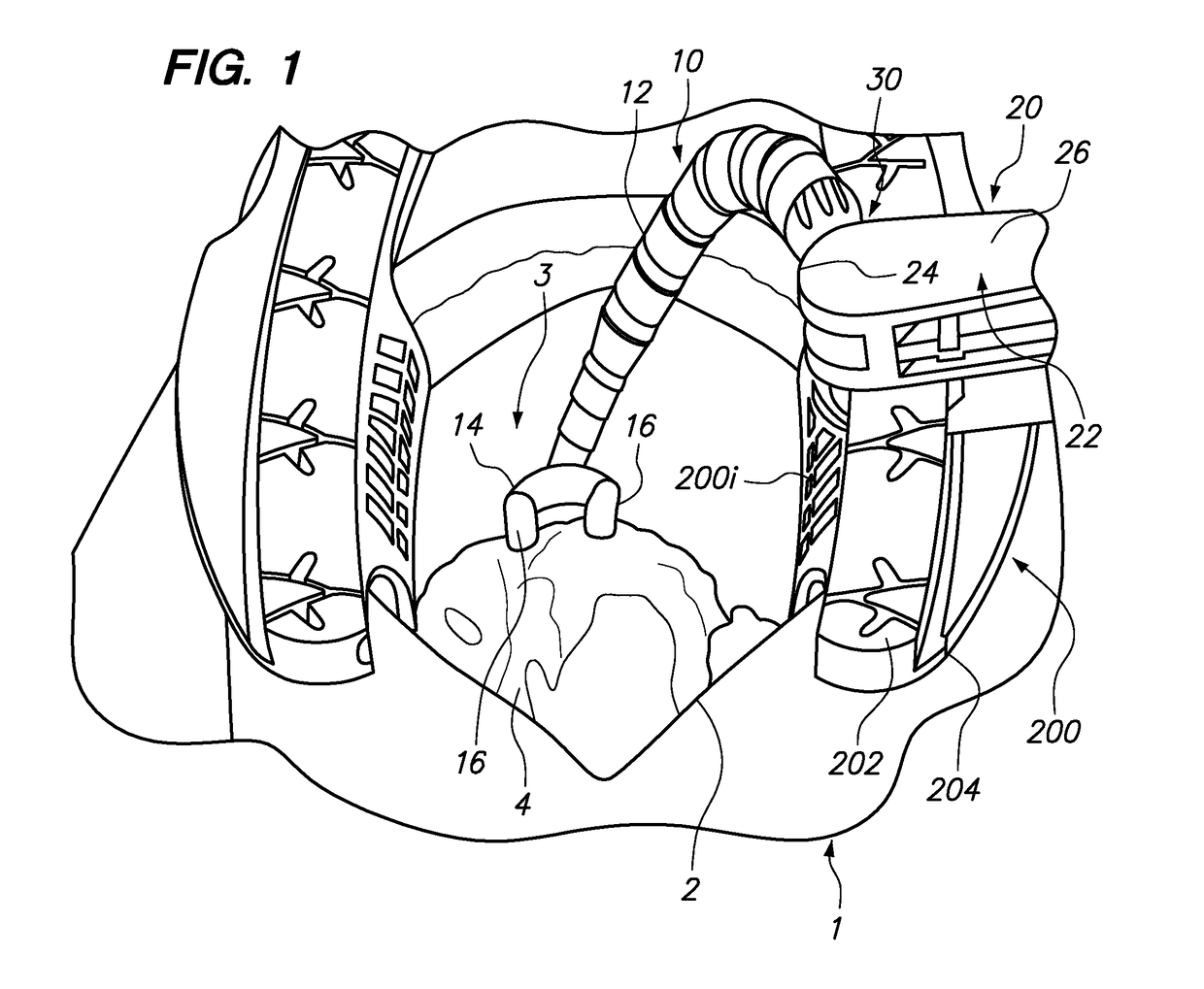 Surgical instruments, systems and methods of use