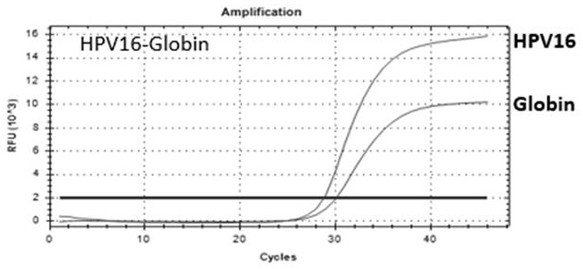 Micro-fluidic chip for detecting HPV viruses and typing