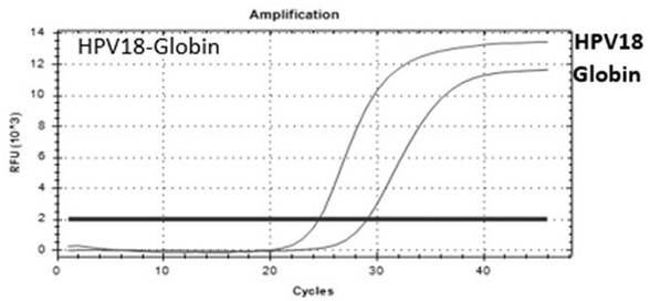 Micro-fluidic chip for detecting HPV viruses and typing