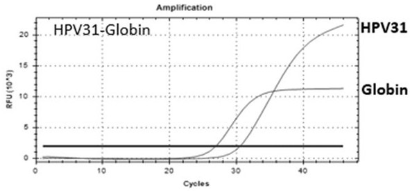 Micro-fluidic chip for detecting HPV viruses and typing